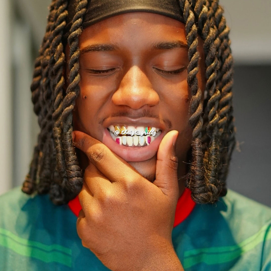 Cameroon Pride & Opal Grillz