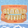 Custom Fully Iced Baguette & Emerald Cut Grillz
