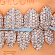 Custom Fully Iced Honeycomb Rimless Setting Grillz