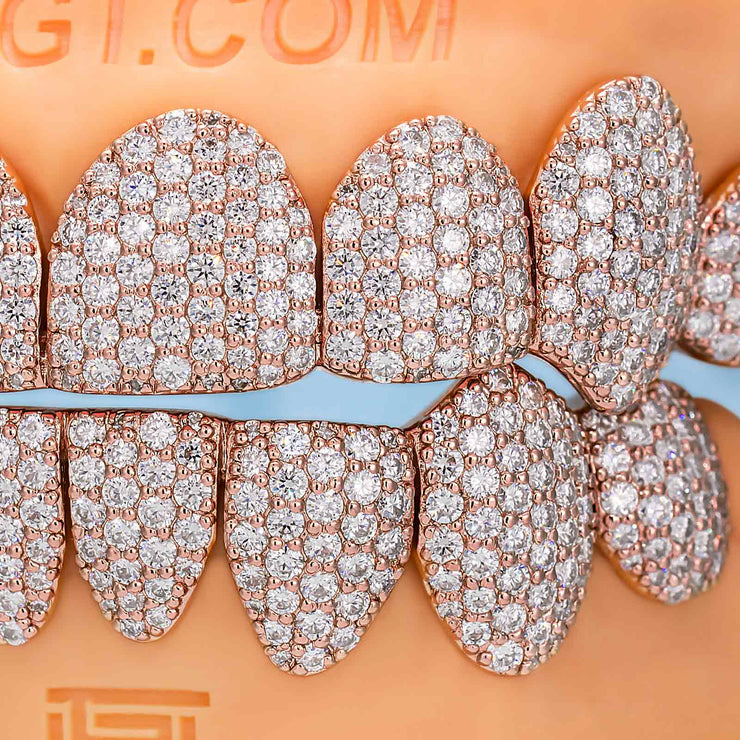 Custom Fully Iced Honeycomb Rimless Setting Grillz