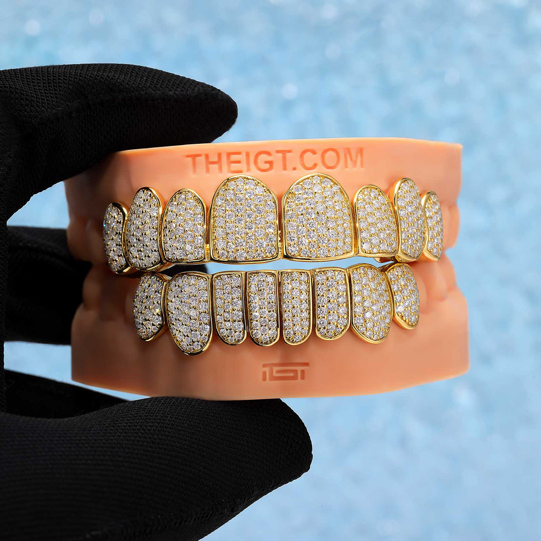 Custom Fully Iced Honeycomb Setting Grillz
