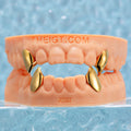 Custom Gold Fang Grillz