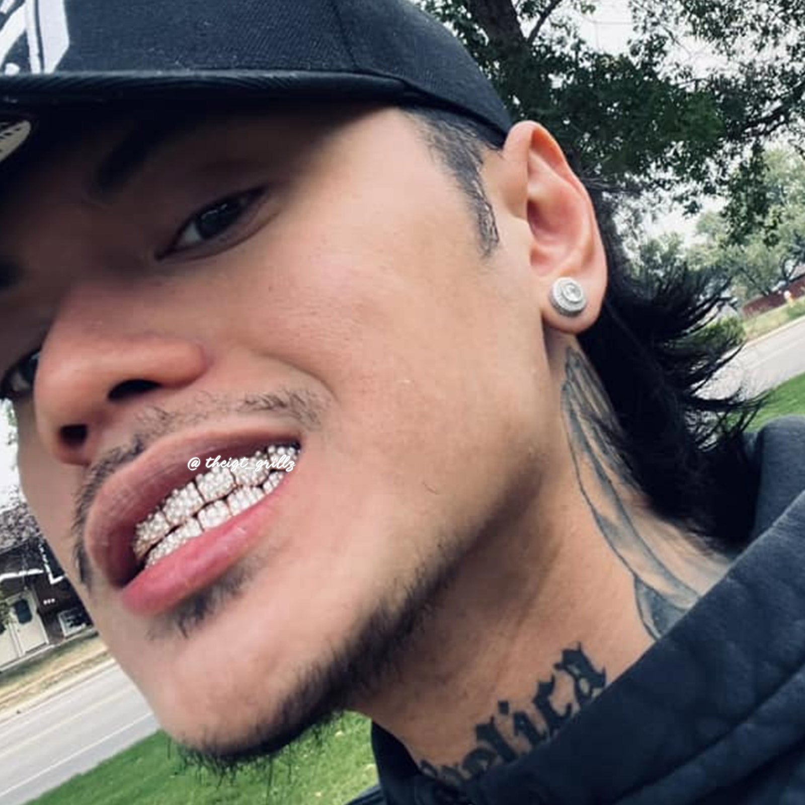 Custom Jumbo (6 Pointers) Moissanite Diamond Grillz