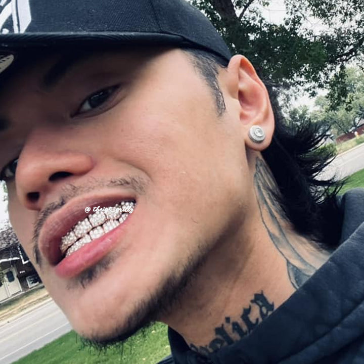 Custom Jumbo (6 Pointers) Moissanite Diamond Grillz