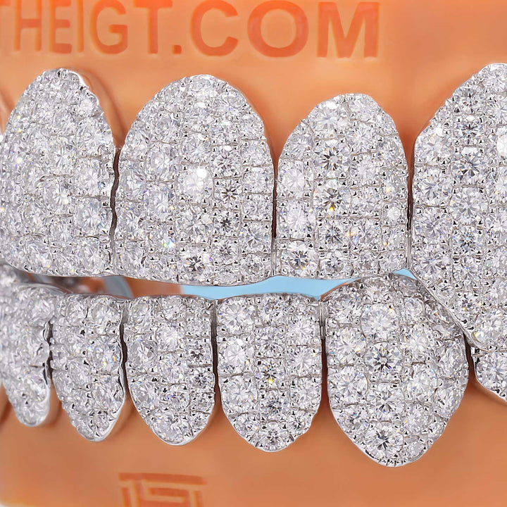 Custom Jumbo (6 Pointers) Moissanite Diamond Grillz