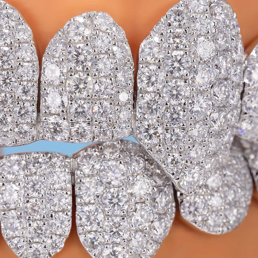 Custom Jumbo (6 Pointers) Moissanite Diamond Grillz