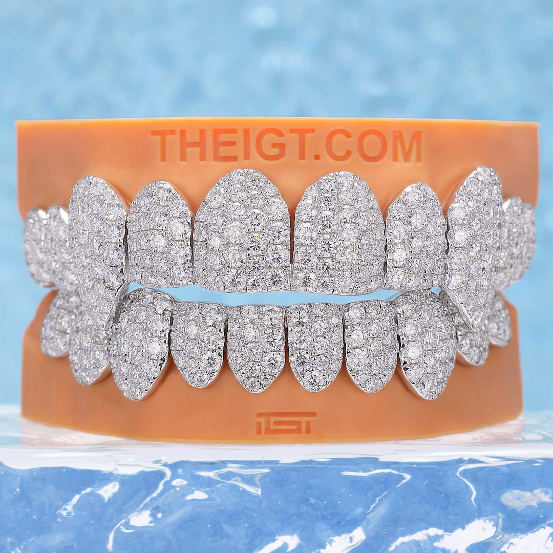 Custom Jumbo (6 Pointers) Moissanite Diamond Grillz