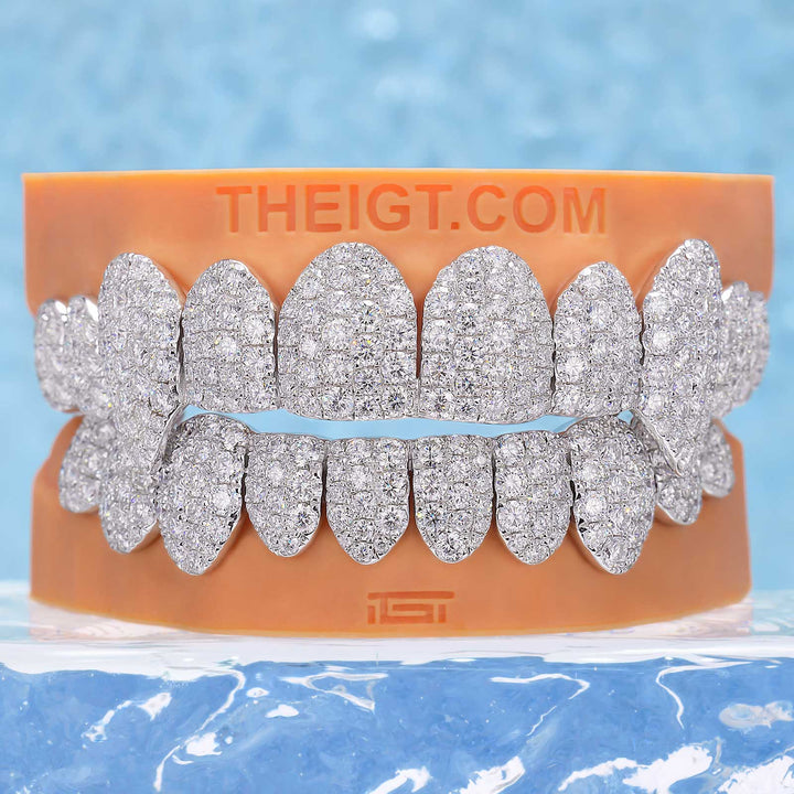 Custom Jumbo (6 Pointers) Moissanite Diamond Grillz