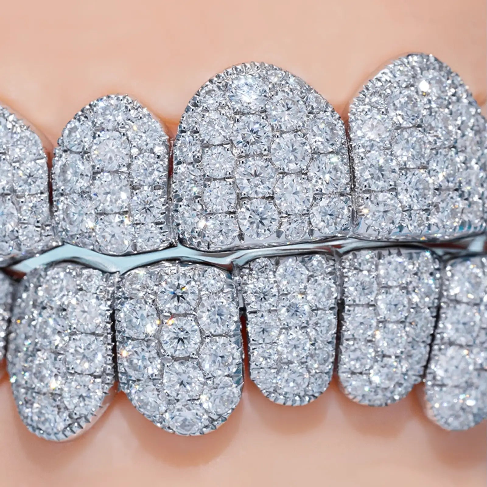 Custom Jumbo (6 Pointers) Moissanite Diamond Grillz