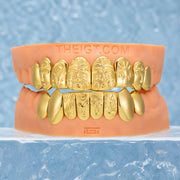 Custom Polished Gold Pattern Grillz