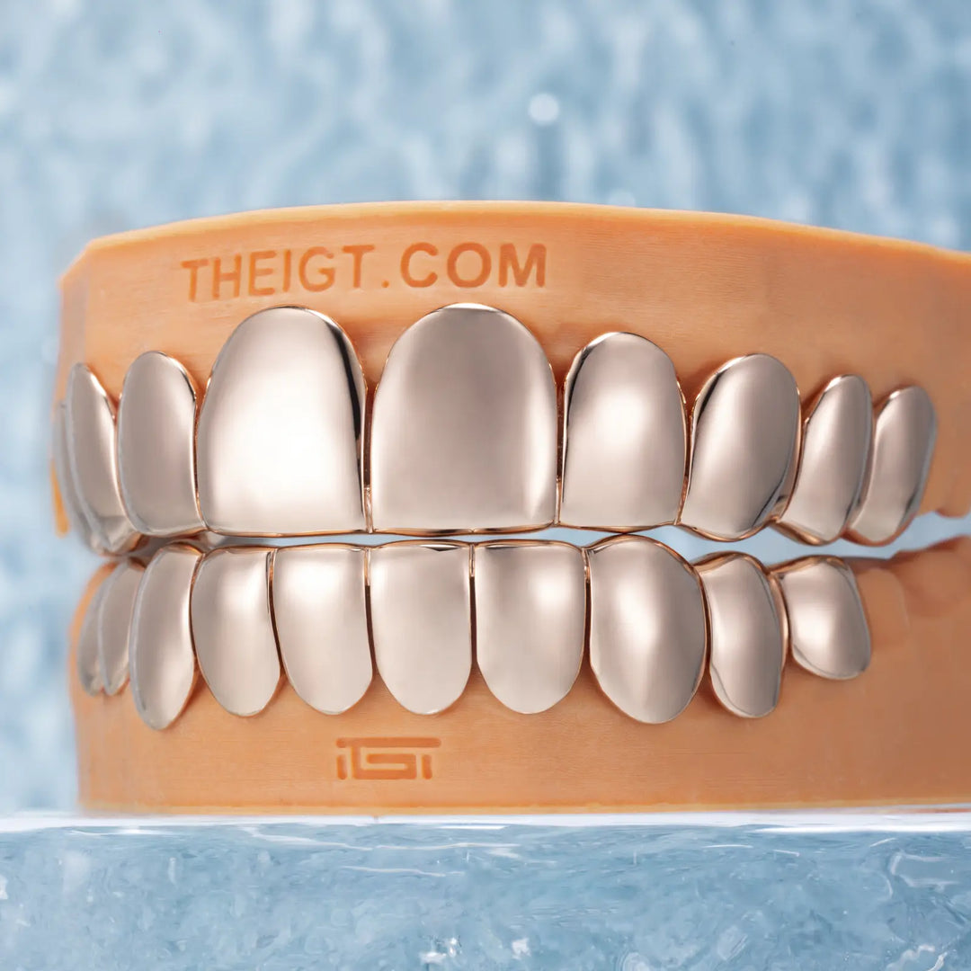 Custom Polished Rose Gold Grillz