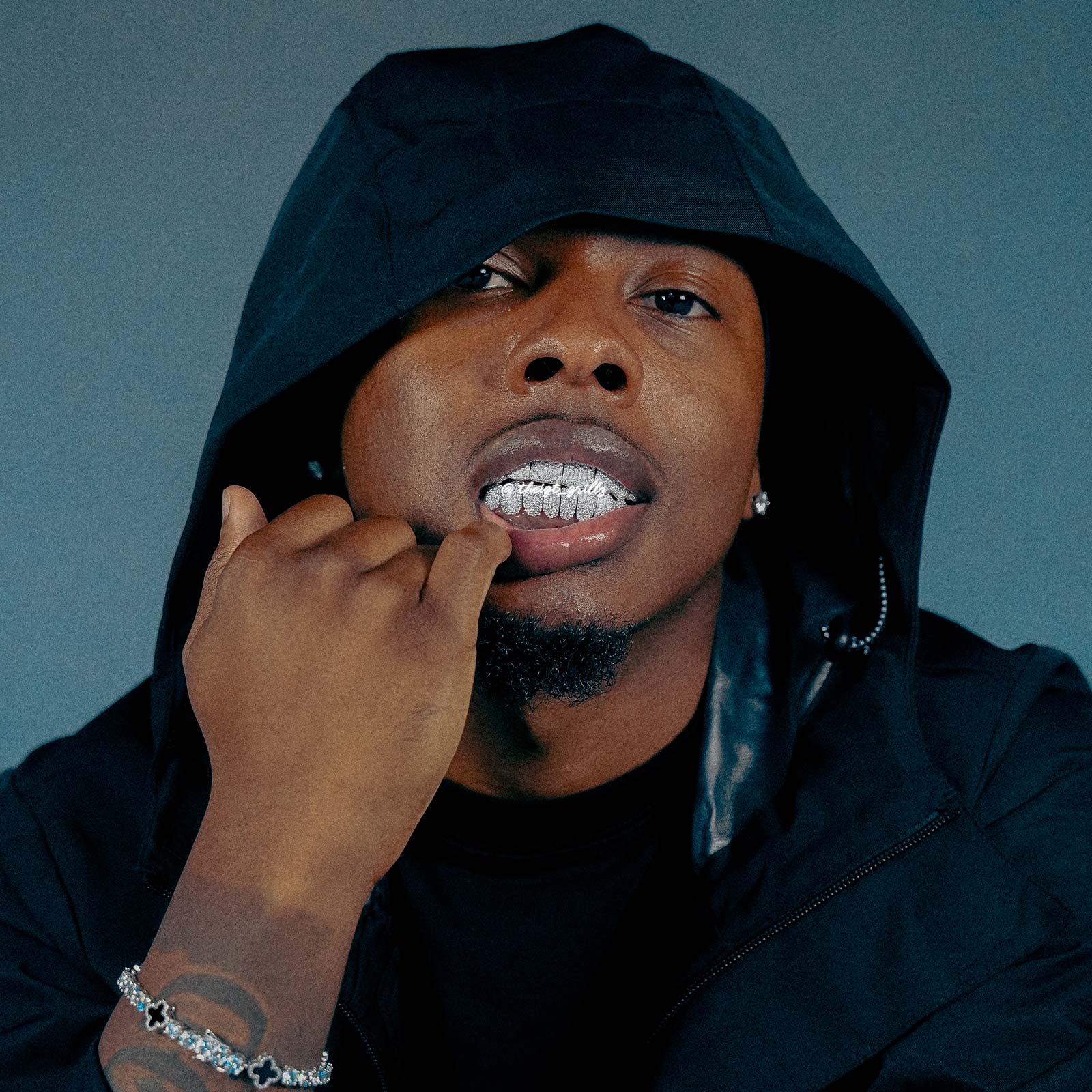 Custom Fully Iced Honeycomb Rimless Setting Grillz