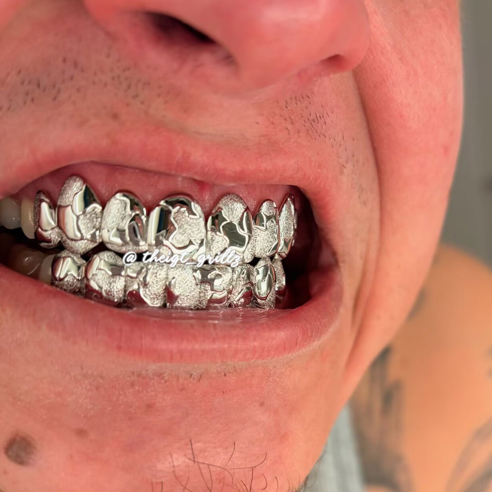 Custom Jigsaw Diamond Dust Gold Grillz - Luxury Diamond Cut & Dust