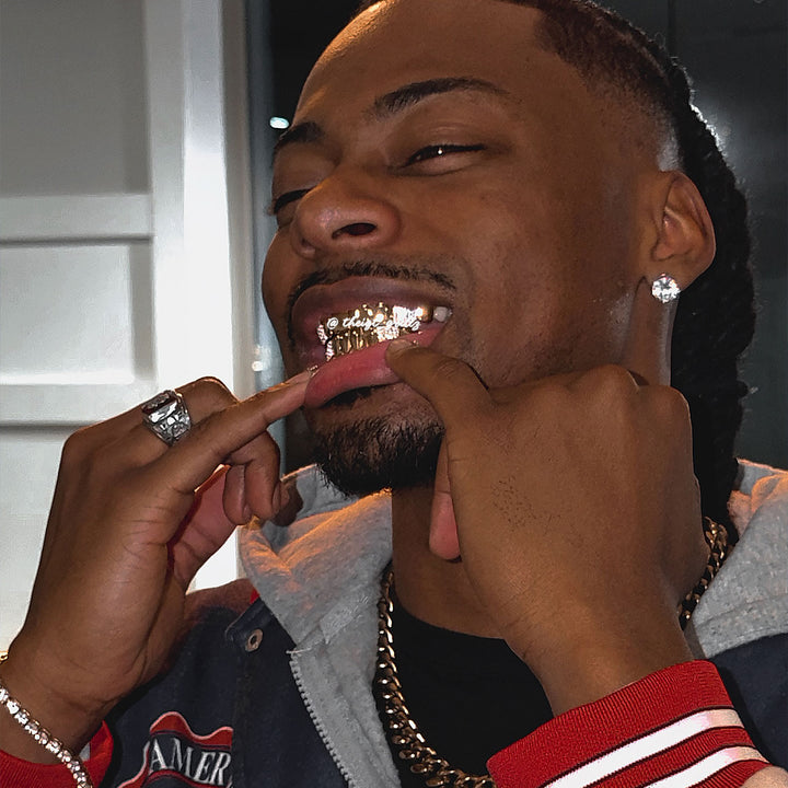 Custom Polished Gold & Diamond Grillz
