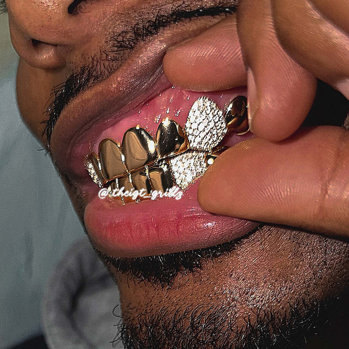 Custom Polished Gold & Diamond Grillz
