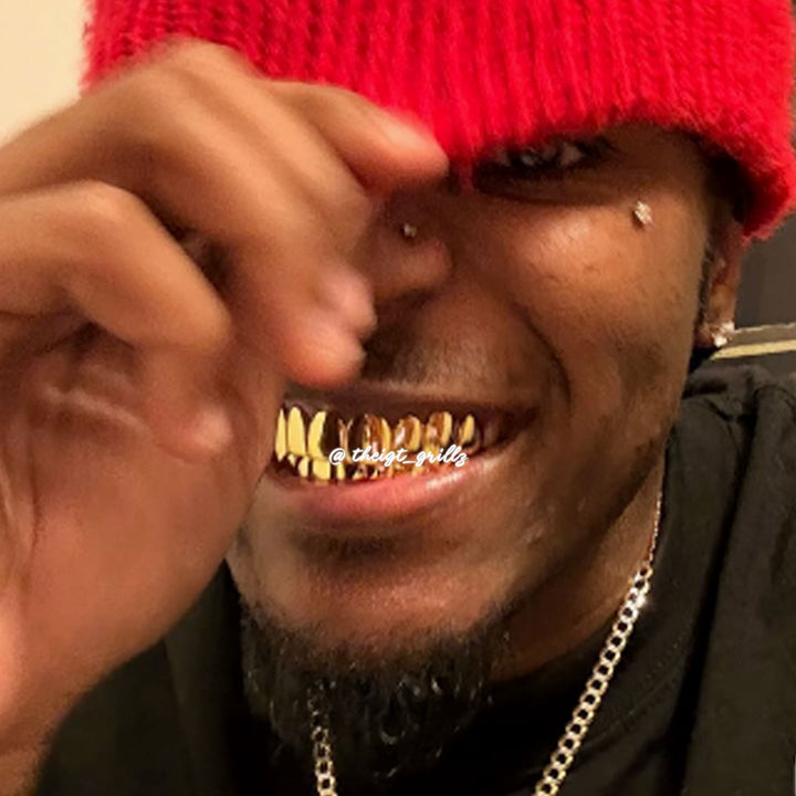 Custom Polished Gold Grillz