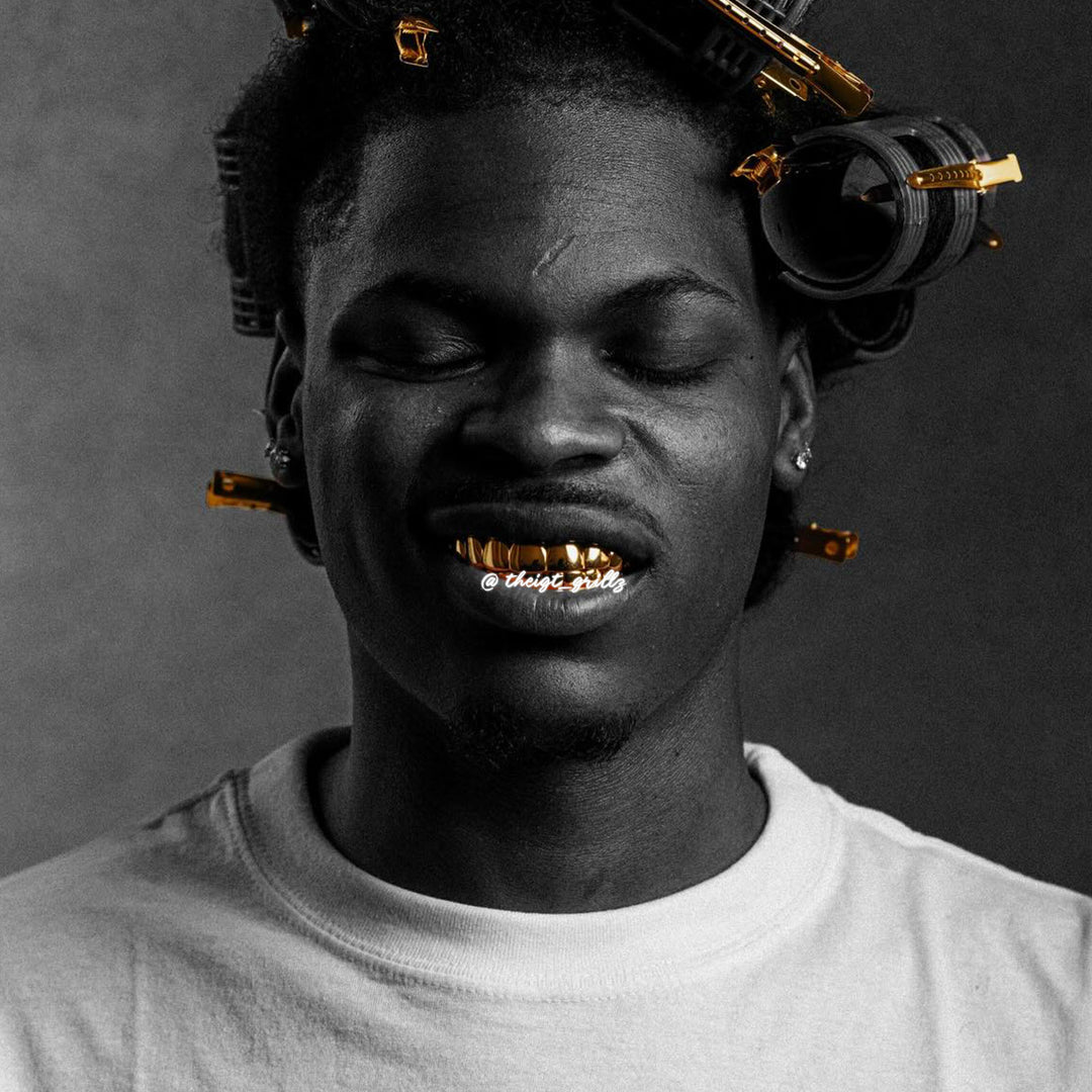 Custom Polished Gold Grillz