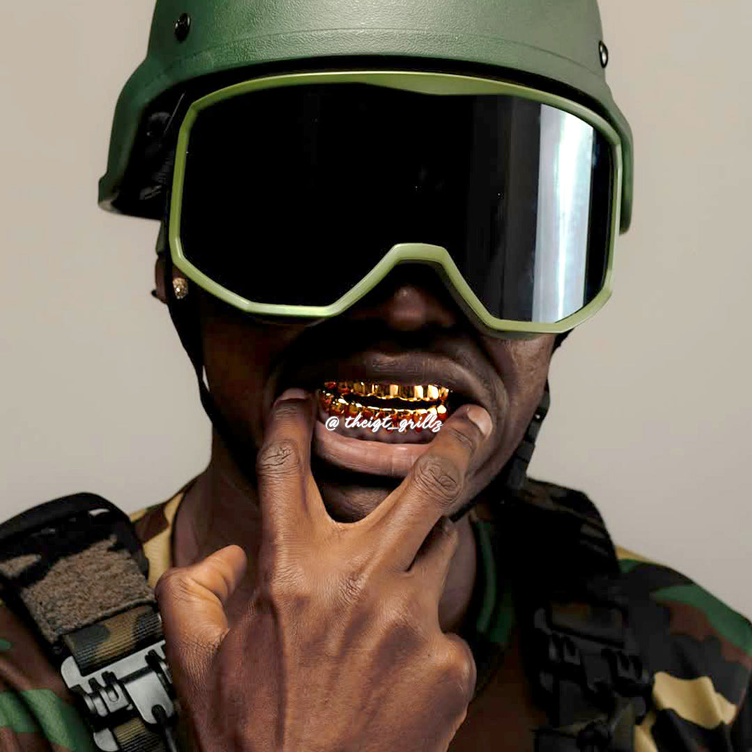Custom Polished Yellow Gold Grillz