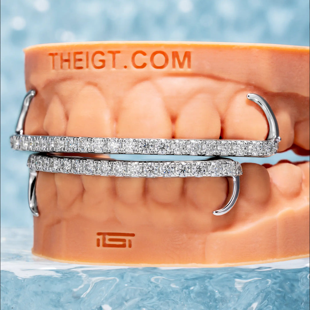 Diamond Bar Grillz