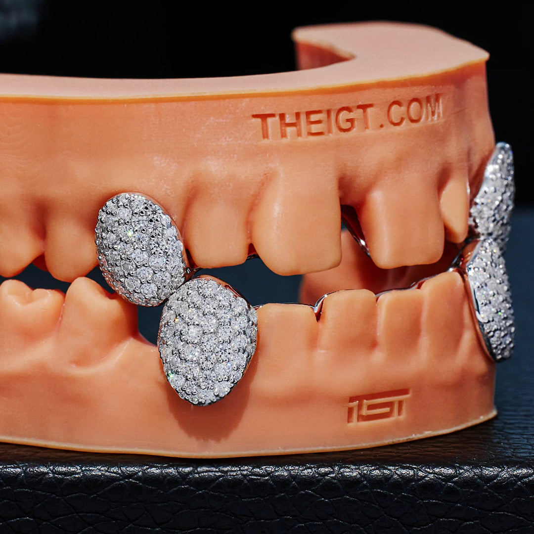 Iced Caps Grillz
