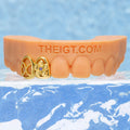 Floral Open Face 2-Cap Letter Grillz