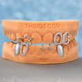 "Gap Star" Iced Open-Face Grillz