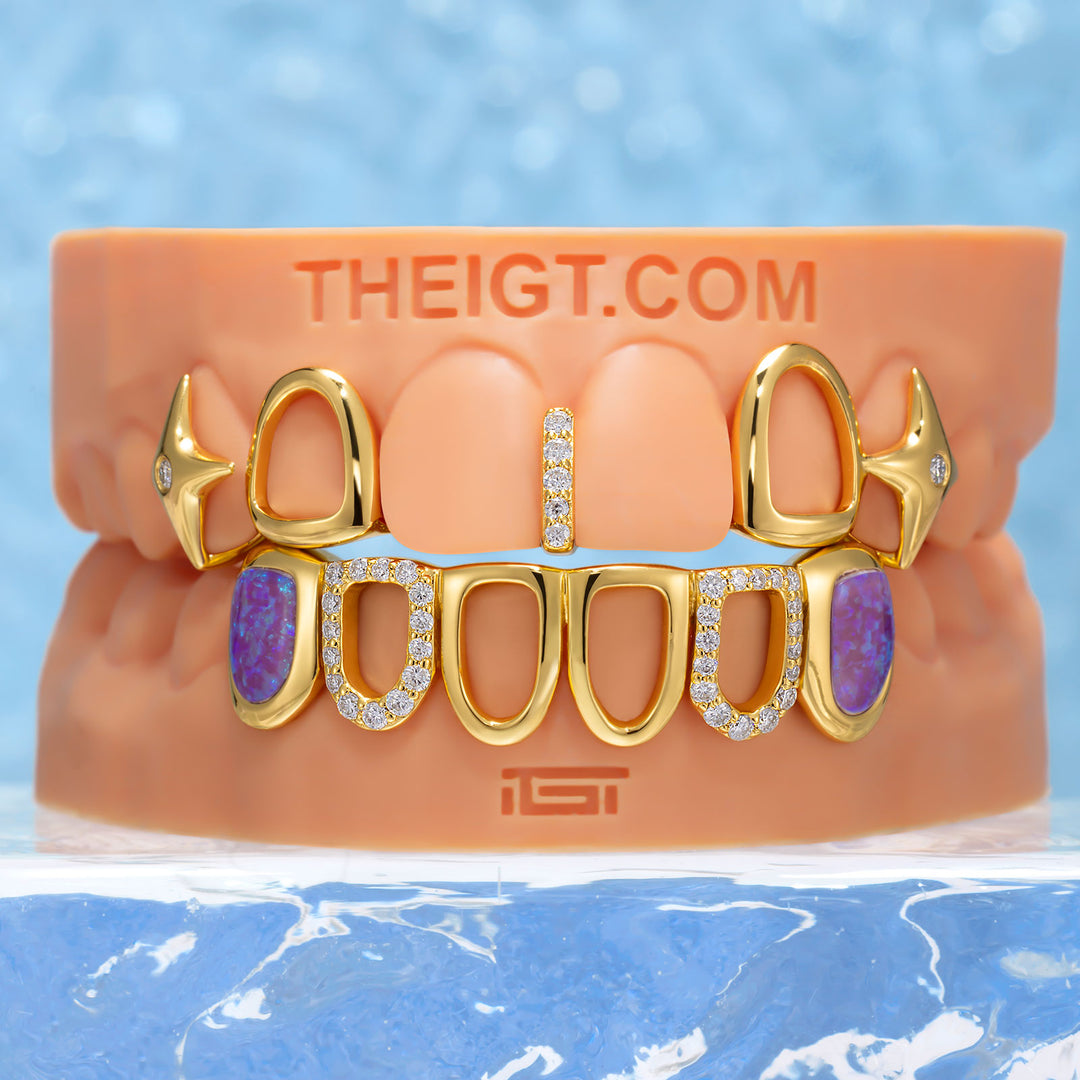 Gold Star Fangs & Opal Open Face Grillz