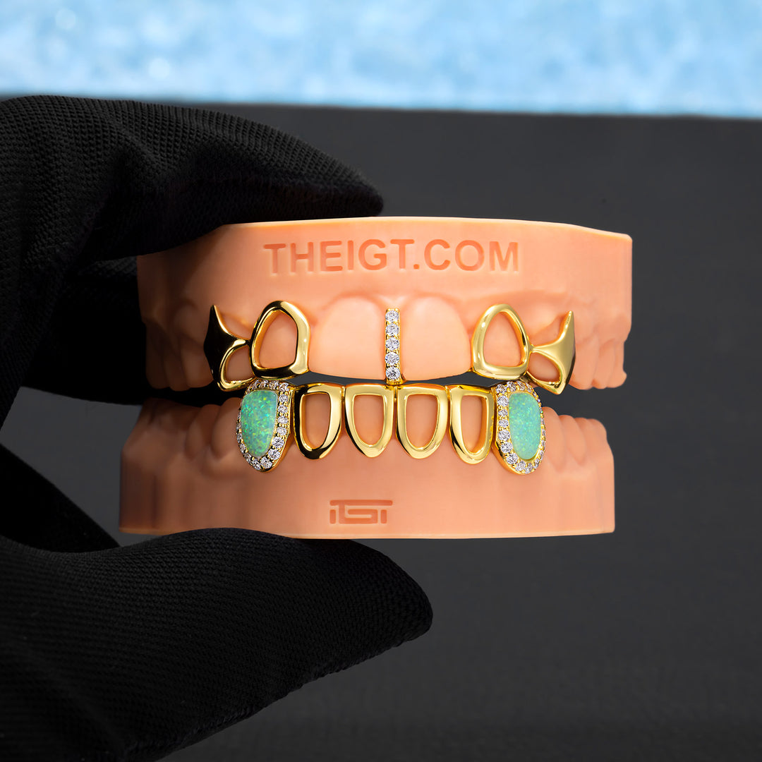 Gold Star Fangs & Opal Open Face Grillz