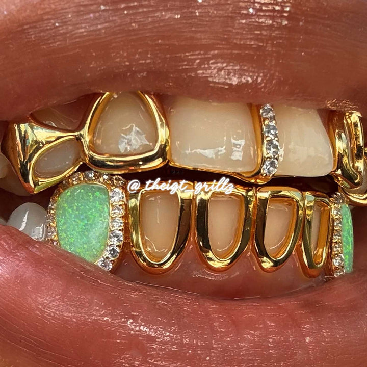 Gold Star Fangs & Opal Open Face Grillz