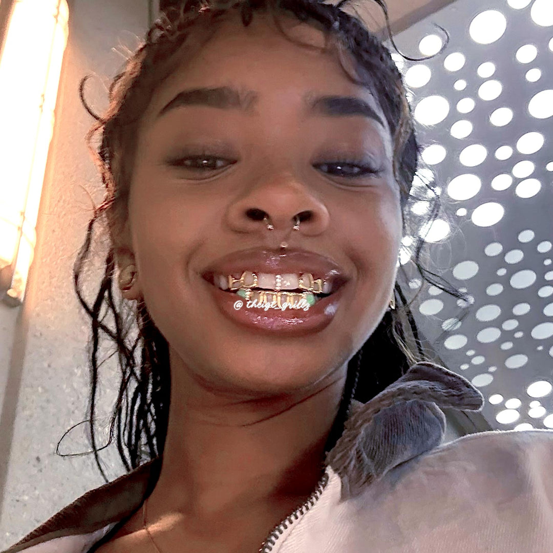Gold Star Fangs & Opal Open Face Grillz