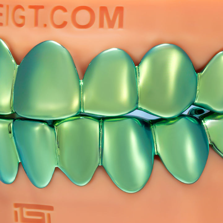 Green Gold Grillz