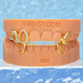"Heart & Star" Iced Open-Face Grillz