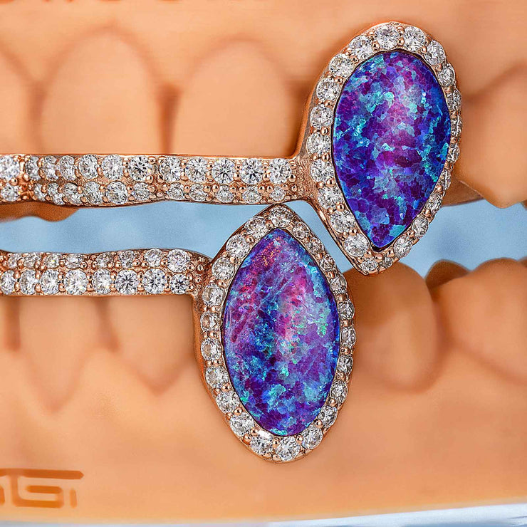 Iced 6 Teeth Connecting Bridge Opal Grillz Bar