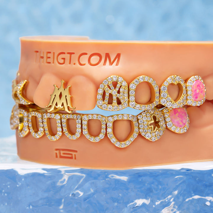 "Iced Star" Signature Custom Grillz