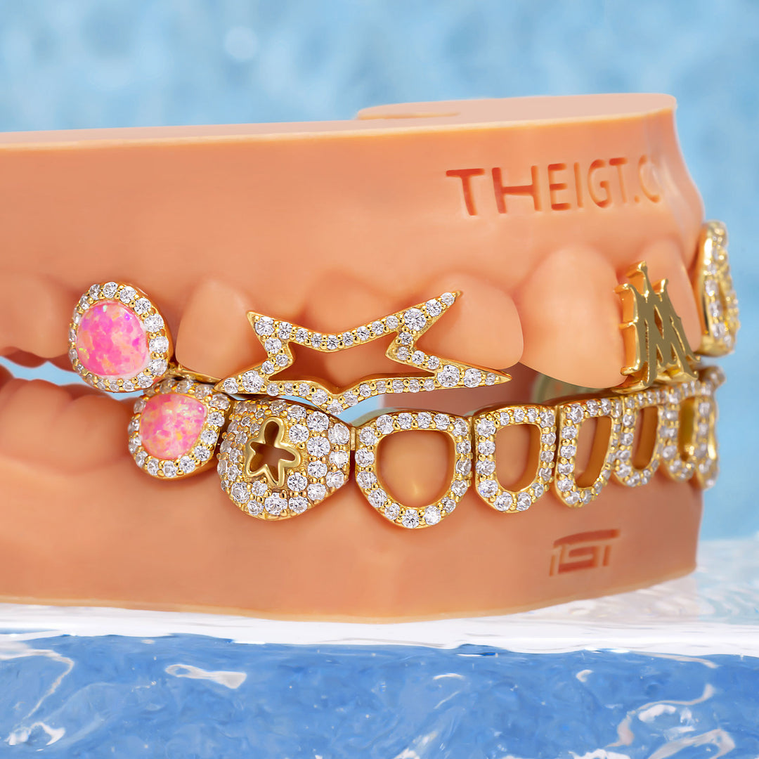 "Iced Star" Signature Custom Grillz