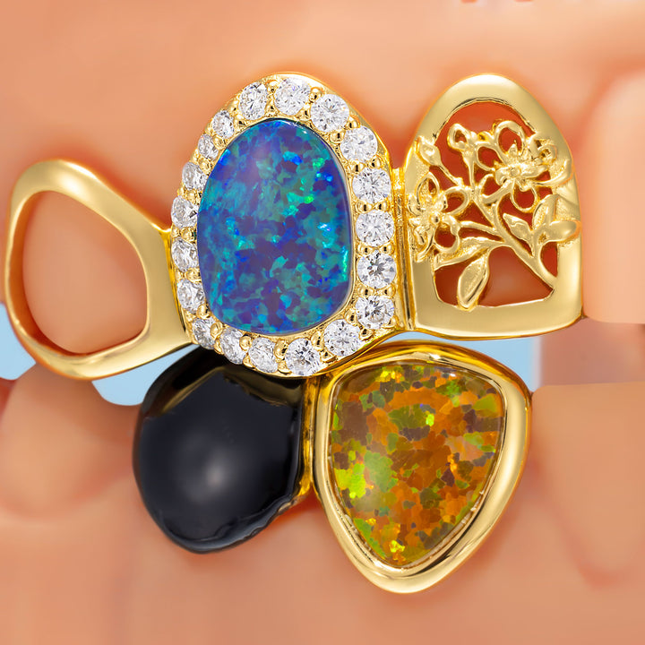 Jamaica Flag Opal Moissanite Open Face Grillz