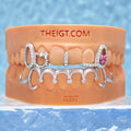 Kitty Bow Drip Open Face Moissanite Grillz - ICEGIANT