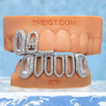 "LA" Oval Gem Open Face Moissanite Grillz