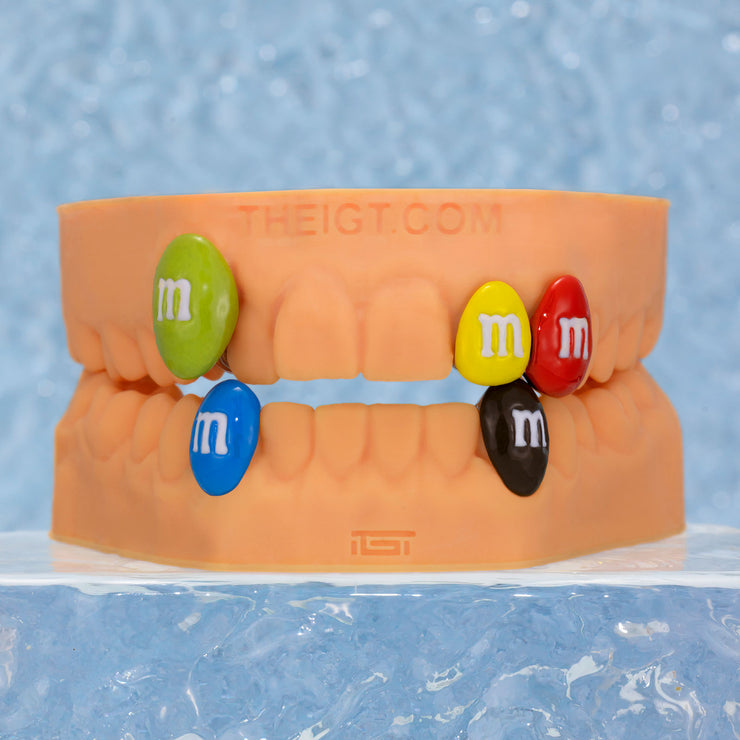 M&