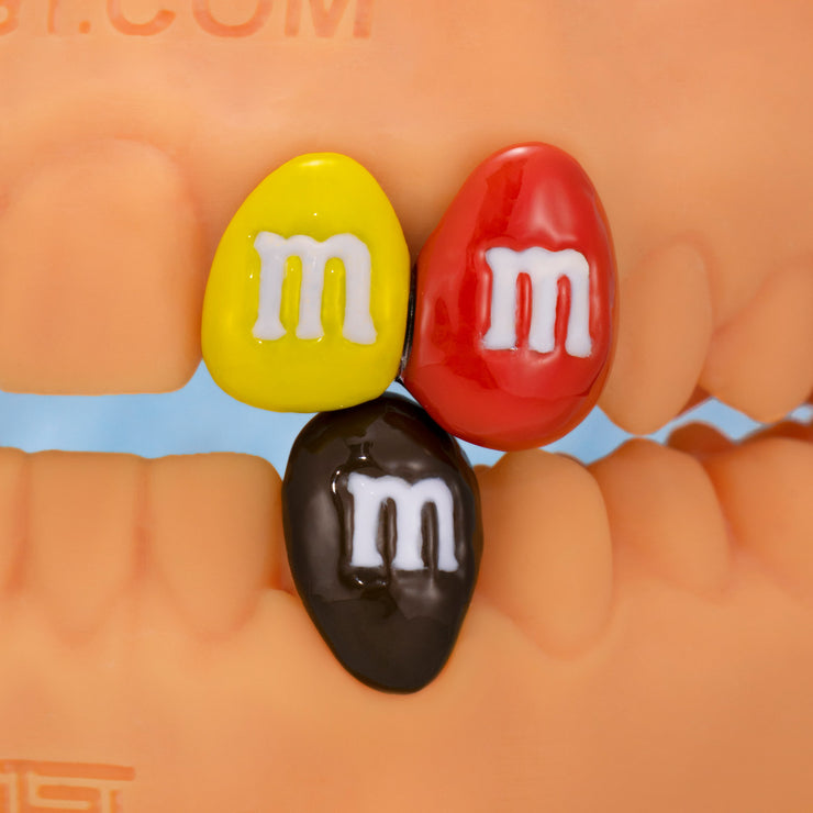 M&