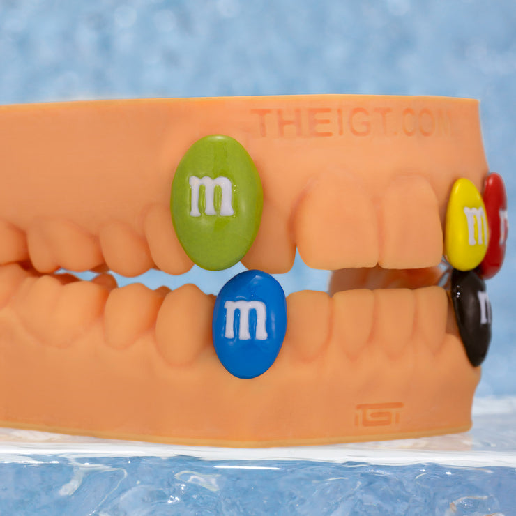M&