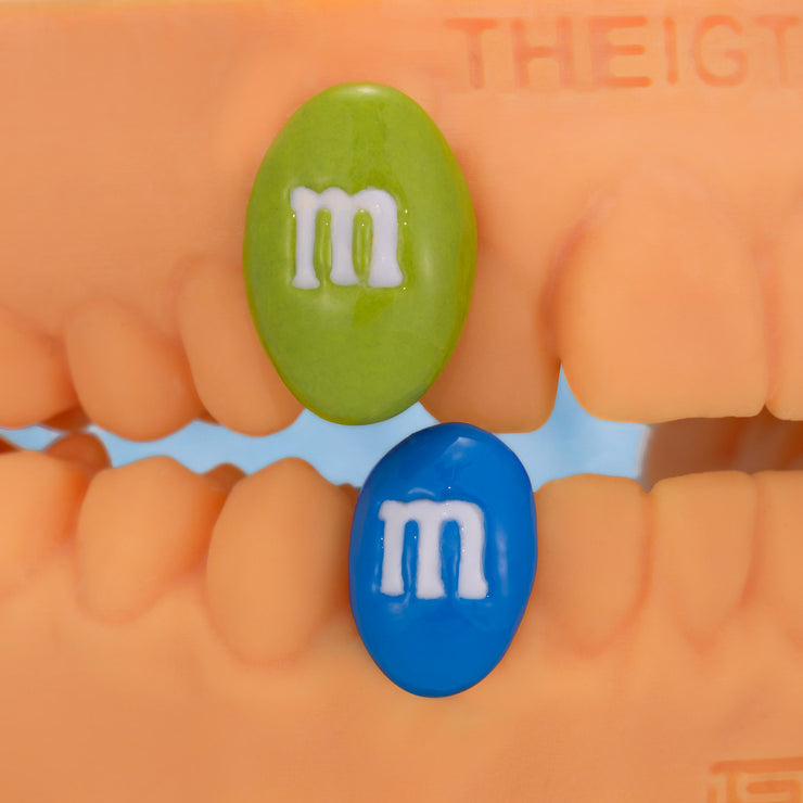 M&