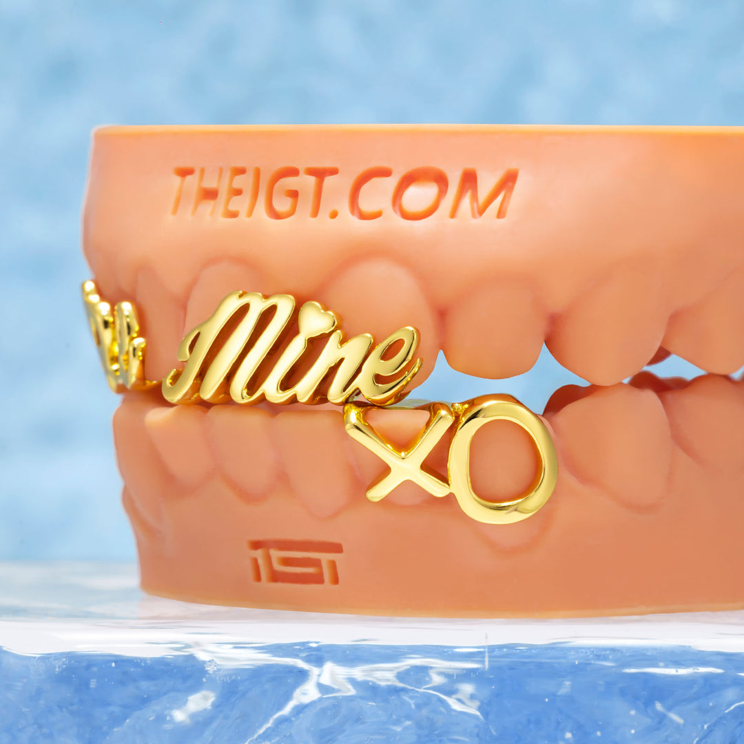 Matching Gold Letter Grillz 'You're Mine'