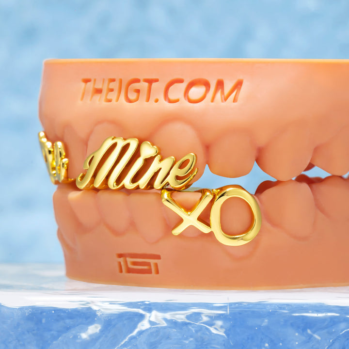 Matching Gold Letter Grillz 'You're Mine'