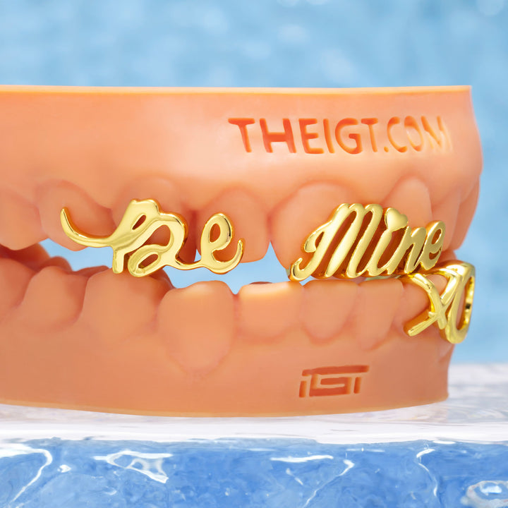 Matching Gold Letter Grillz 'You're Mine'