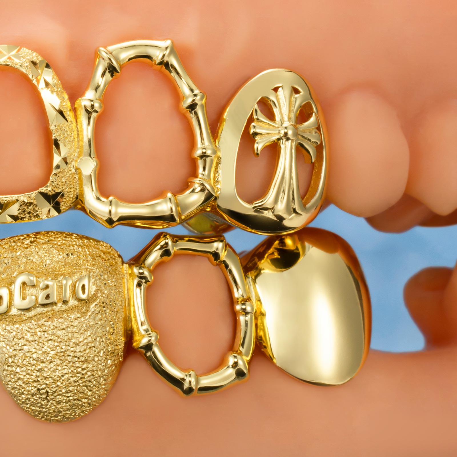 Open Face Enamel Metro Yankee Muse Grillz