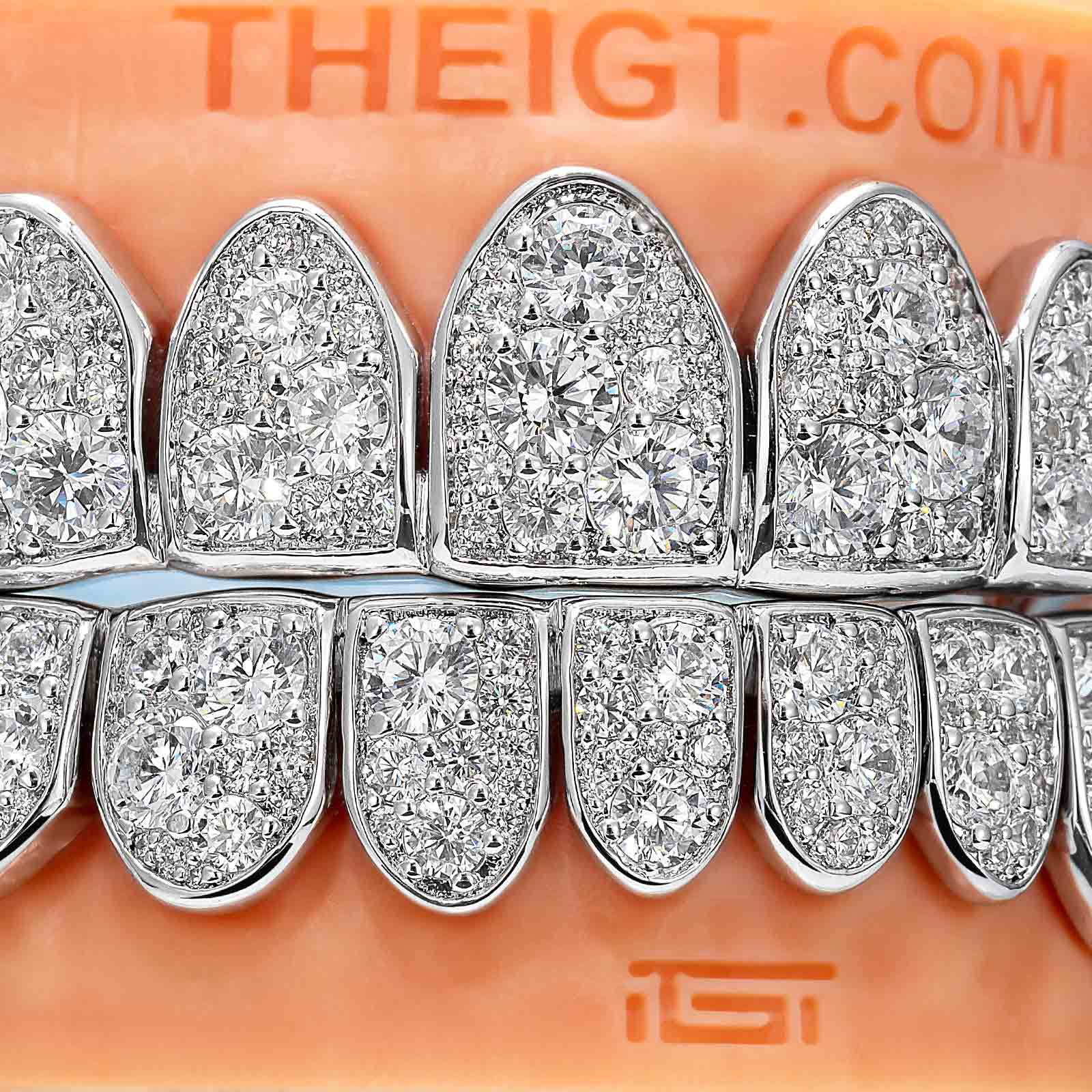 Mosaic/Snow Set Moissanite Diamond Grillz