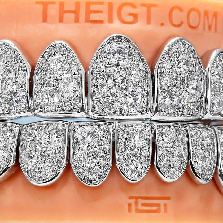 Mosaic/Snow Set Moissanite Diamond Grillz