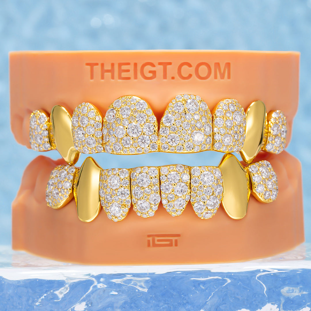 Mosaic/Snow Set Moissanite Diamond Grillz
