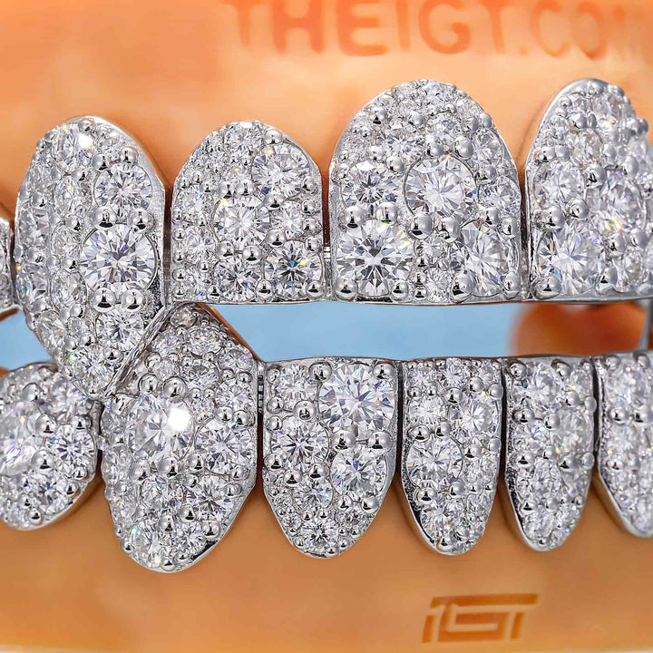 Mosaic/Snow Set Moissanite Diamond Grillz